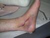 3377timfoot3.jpg